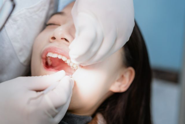 口を開けて歯科治療を受ける女性