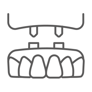 入れ歯（義歯）